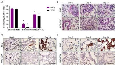 NSG Mice Facilitate ex vivo Characterization of Ewing Sarcoma Lung Metastasis Using the PuMA Model